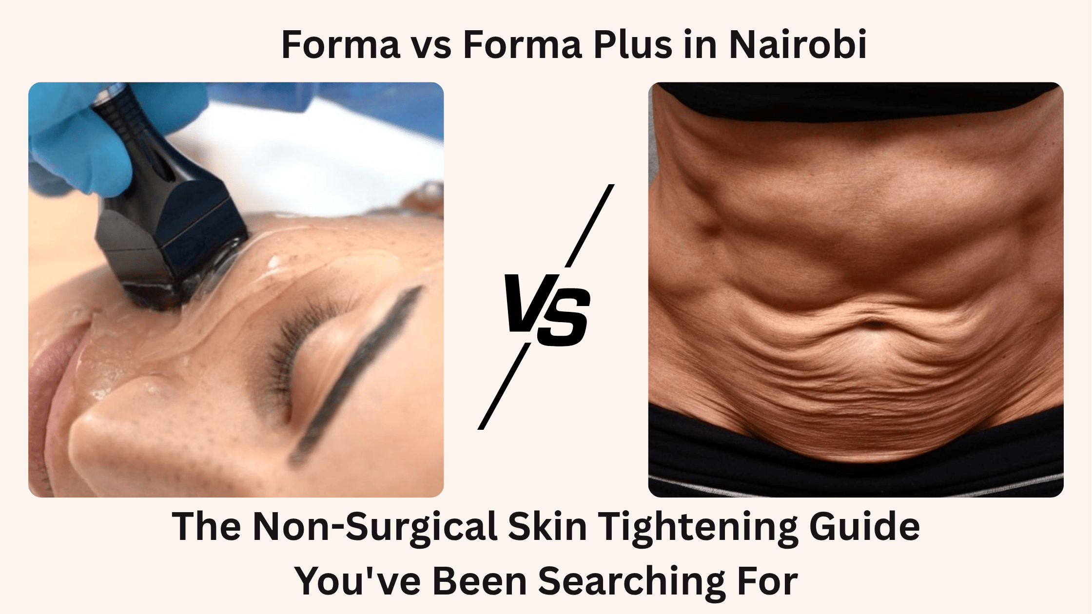 Forma vs Forma Plus in Nairobi