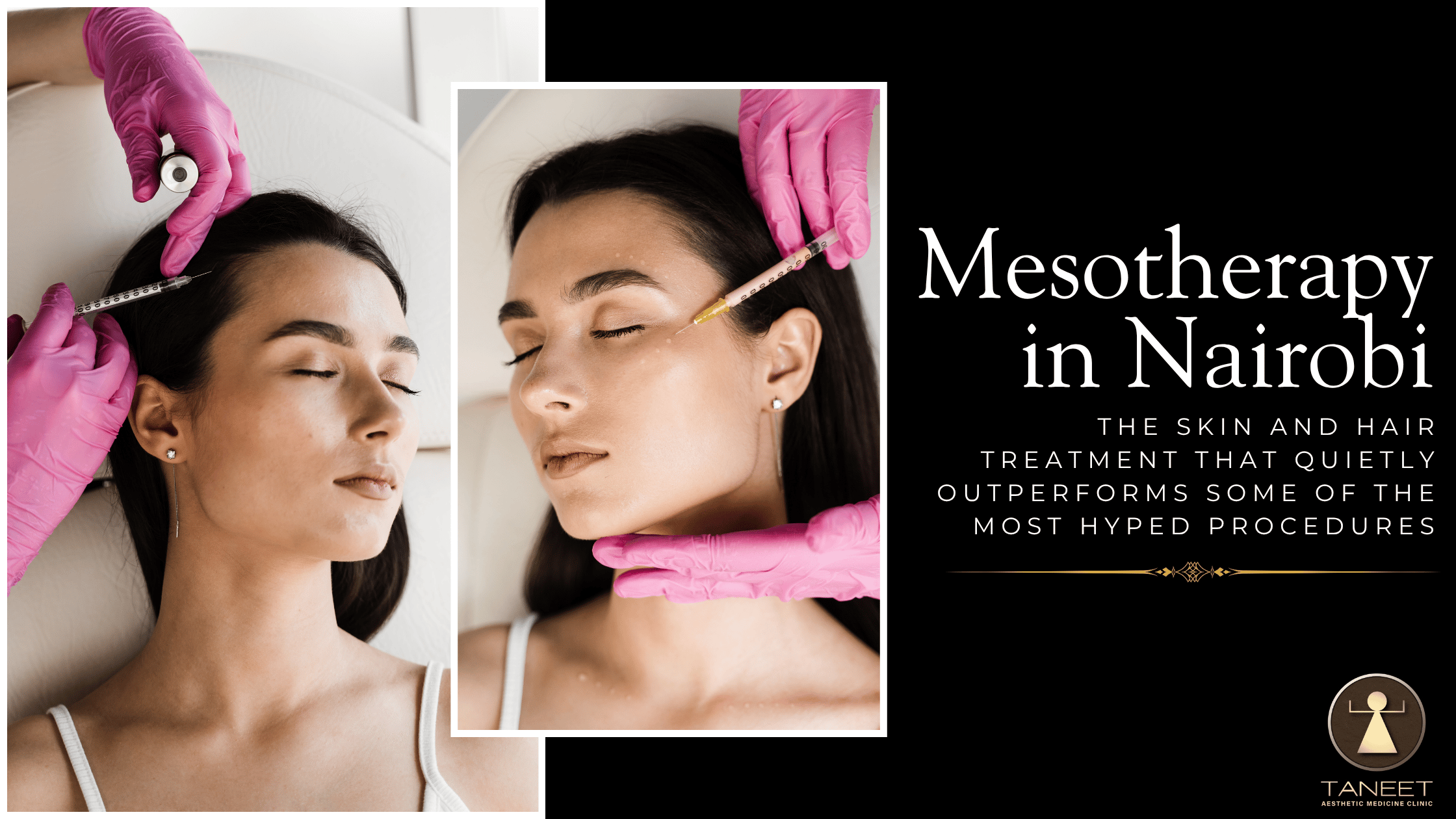 Mesotherapy in Nairobi