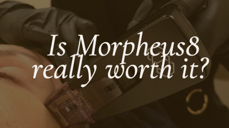 Morpheus8 acne scars Nairobi