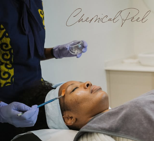 chemical peel dark skin Nairobi